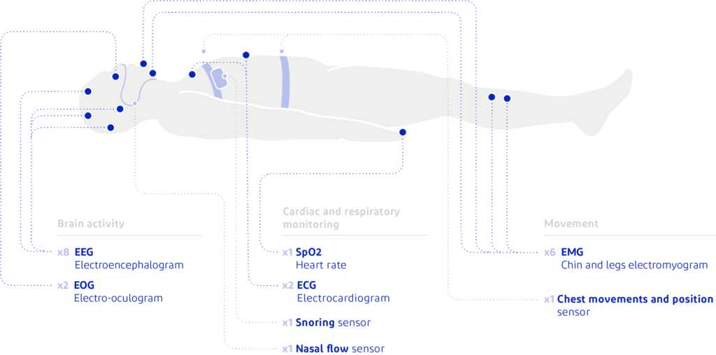 Technical diagram of polysomnography assessments