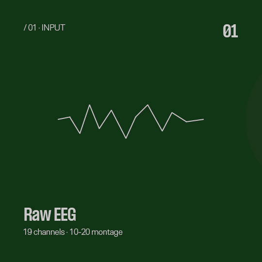 Input- Raw EEG