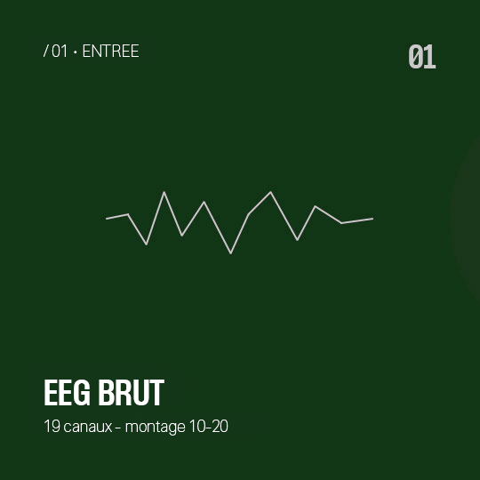 Input - EEG brut